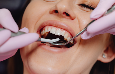 Dental Check Up