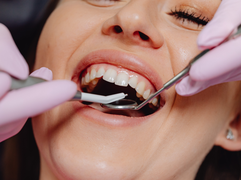 Dental Check Up